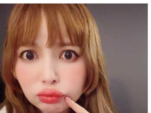 「すぐに病院行くべき」中川翔子、唇が“5倍”になった姿に心配の声続出「普通に心配」「お大事に」