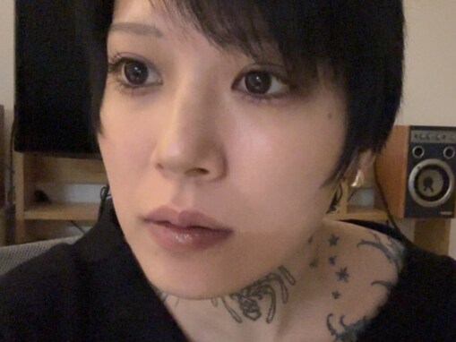 「辛すぎる」元アイドル、電気治療でやけど負う“普通に泣いた”赤裸々に吐露「EMSでやけどやばいな…」