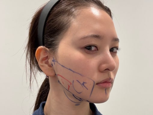 「どうしてあんなに叩かれたんだろう？」兒玉遥、過去に整形やカラコンでバッシング受け心境を吐露