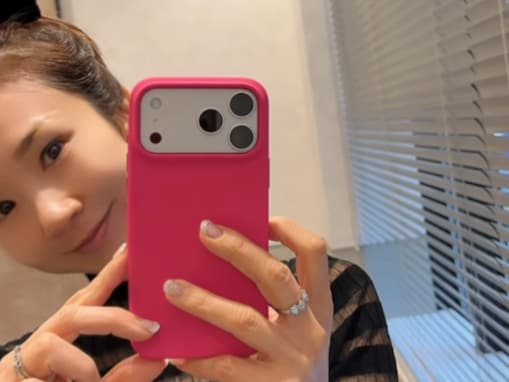 「てか一生かわい！」ほしのあき、シミ取りレーザー受ける「ダウンタイムもないし、痛くない」明かす