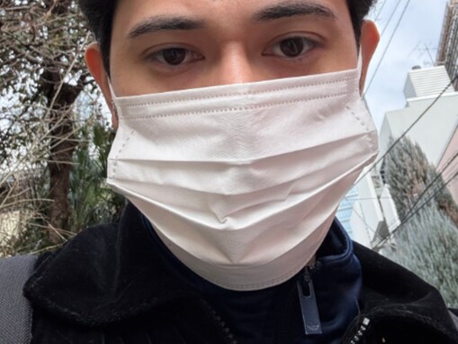 「額に？！」人気YouTuber、奇跡的なハプニングを報告！ 「強運すぎる!?」「狙ってもできない神業」