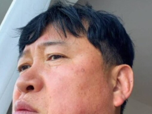 「顔変わりすぎ！」スギちゃん、激変ショットに心配の声。「腫れてる」「病院に行った方がイイゼェ～」