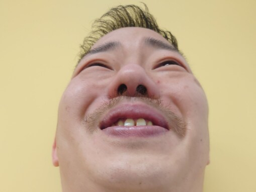 「甲状腺の病気の心配が」人気芸人、「首が太くなりすぎ」な相方の写真に心配の声「まずは病院？」「ほぼ親指」