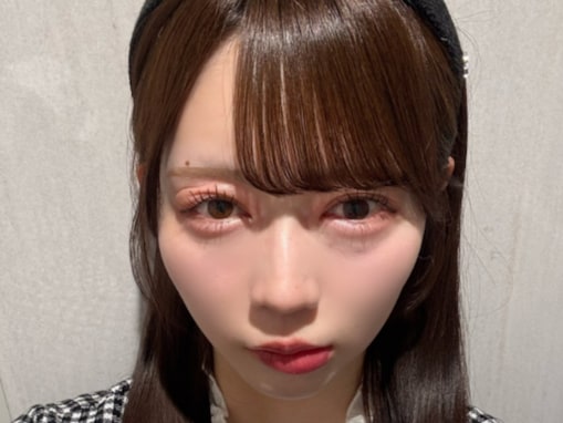 「助けて何もできない」女性アイドル、夜になると“目も唇も腫れ上がって”パンパンに。心配の声続出