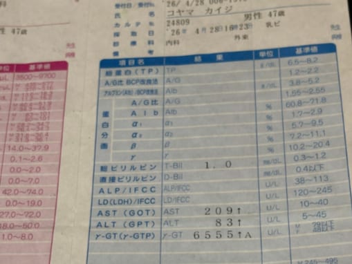 お笑い芸人、肝硬変＆双極性障害を告白「さあ、酒を飲み始めてからの25年を、これから取り戻してやろう」