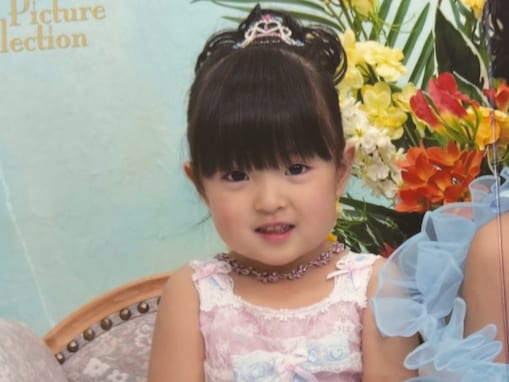 「ウォニョンに見えた」女性YouTuber、幼少期から20歳のビフォーアフターに「なりたい顔すぎる」反響