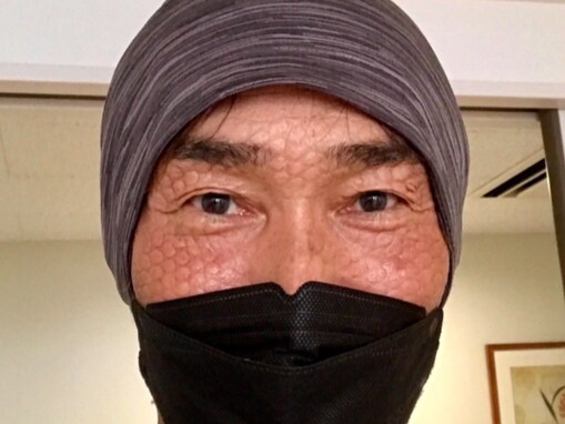 「苦しんでました」元うたのおにいさん、がんサバイバー時代を振り返る「動くのもままならないくらいしんどく」