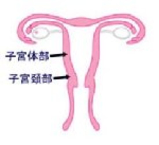 『子宮頚がんは』子宮の入り口に発生する癌です