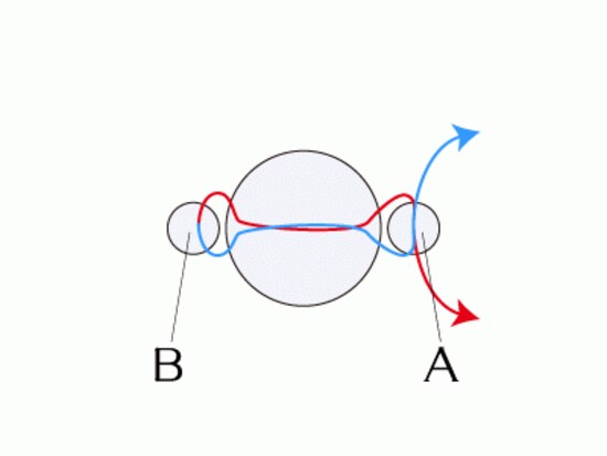 パールリング