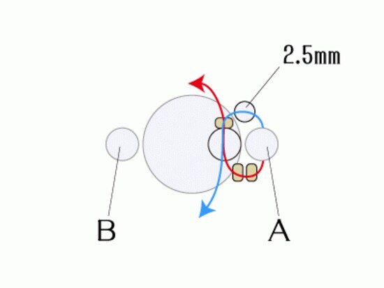 パールリング