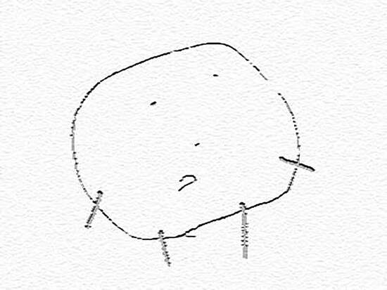 子供の絵画発達を見守る