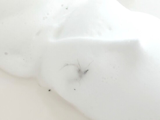 排水管の汚れがオーバーフローから吹き出してくる