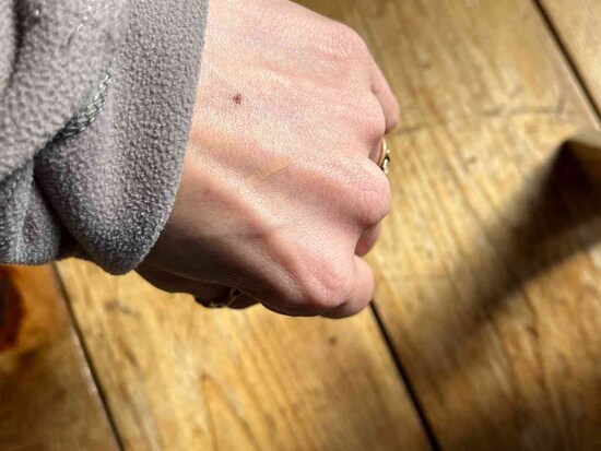 ダイソーの「アイプチ」はつけていても目立たない
