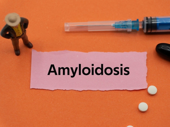 アミロイドーシスとは
