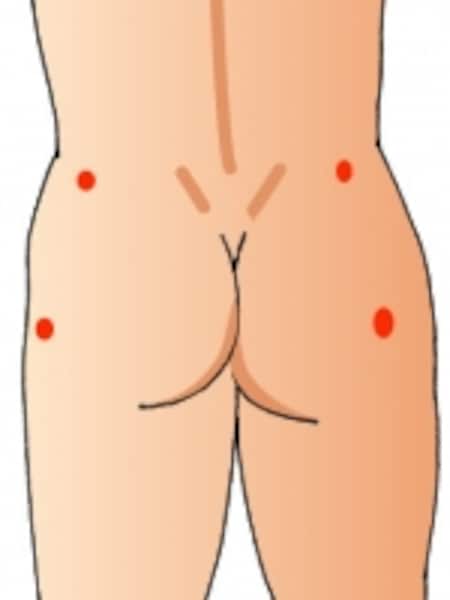 腰のあたりの圧痛点です