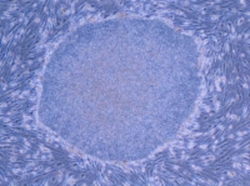 aa