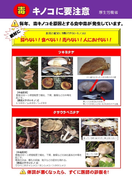 毒きのこ今昔 : 中毒症例を中心にして 毒きのこ今昔: 中毒症例を中心にして | 奥沢 康正 |本 | 通販