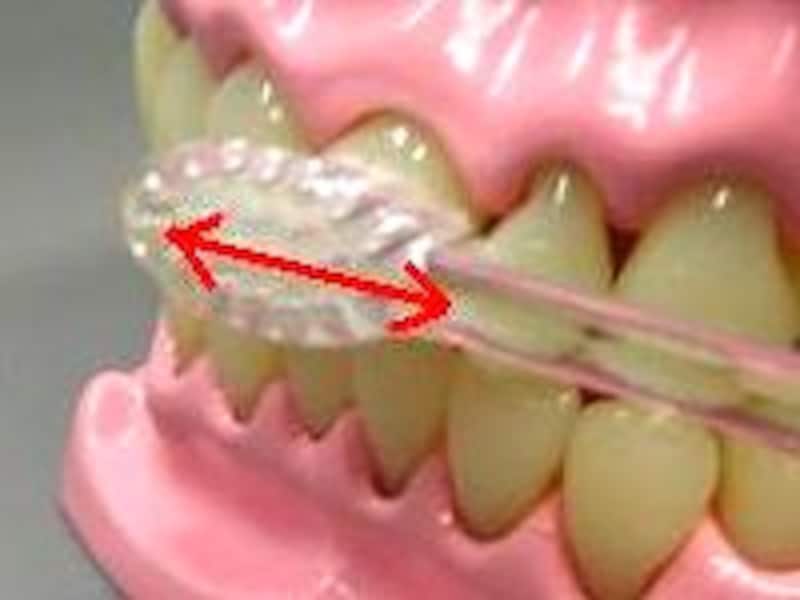 虫歯にさせない!仕上げ歯みがきのポイント!