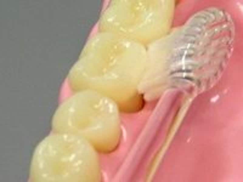 虫歯にさせない!仕上げ歯みがきのポイント!