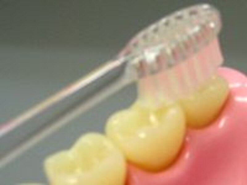 虫歯にさせない!仕上げ歯みがきのポイント!