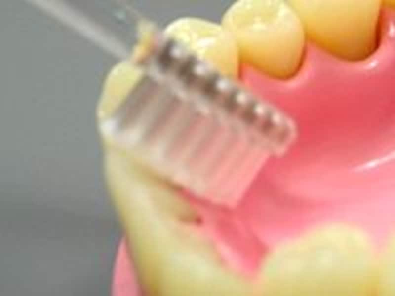 虫歯にさせない!仕上げ歯みがきのポイント!