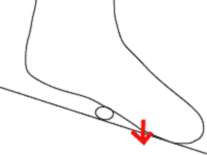 膝が伸び、体重が後ろに引けて、小石などに靴底の中央から後ろで乗ってしまうというのは最悪