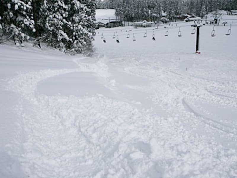 画像の代替テキスト