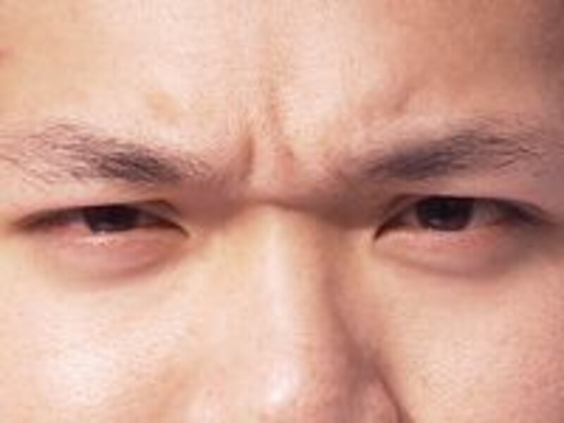 男性にも利用者が多い眉間のシワ改善治療。いいドクターを見つけるために努力を惜しまず自分自身の知識も増やしましょう
