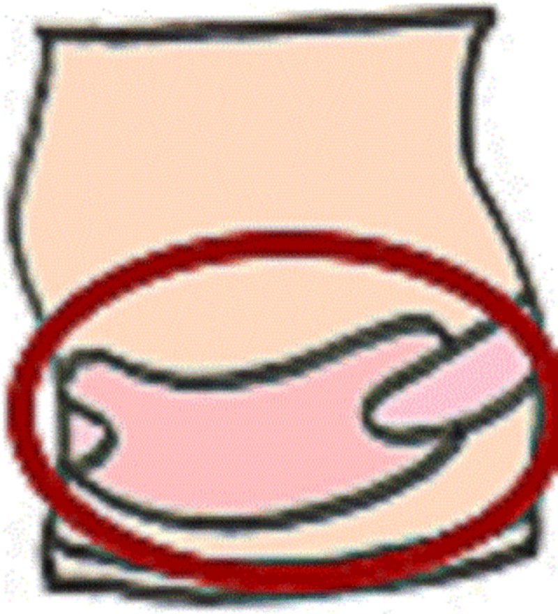 補助腹帯は、取り外し可能だが、別途お金がかかり面倒でつけなくなったりすることも