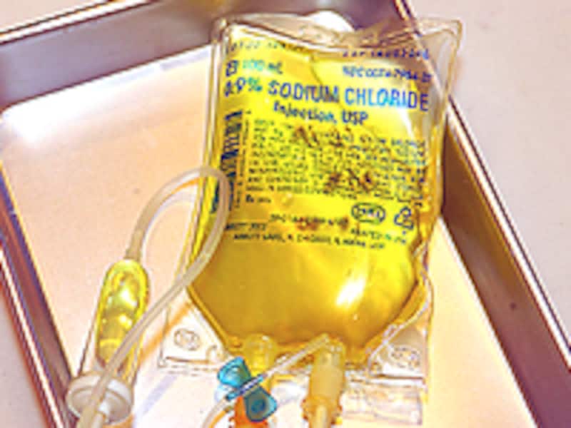 キレート剤の点滴