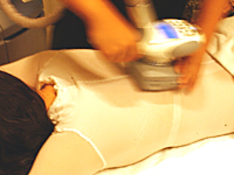 エンダモロジー背中