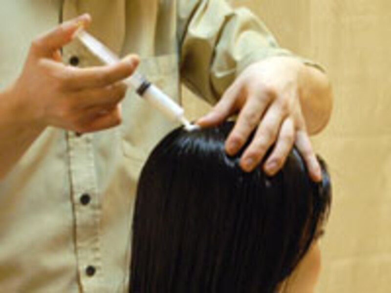 頭皮トリートメント