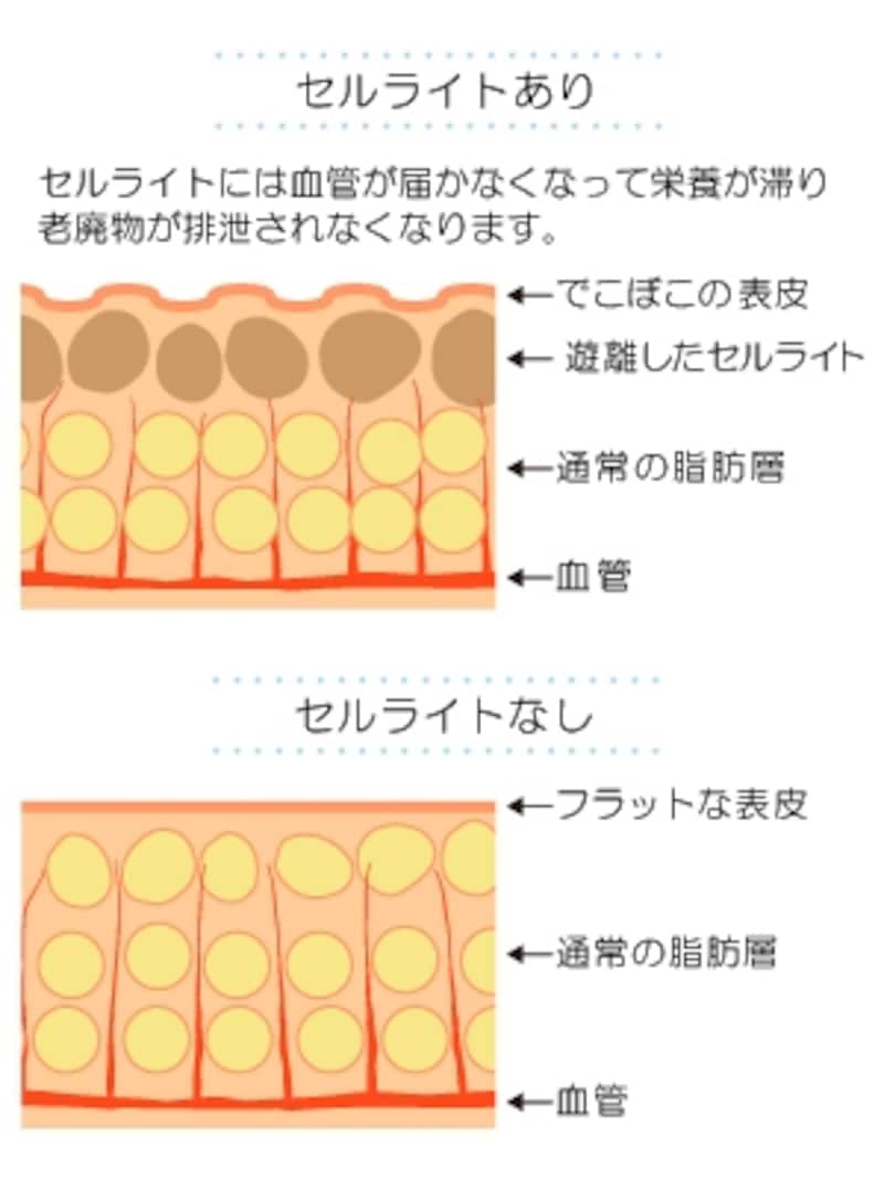 セルライトの仕組みを詳しくチェック！