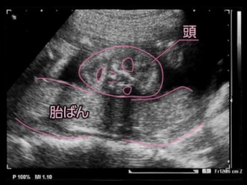 妊娠6ヶ月目 妊娠 23週の胎児の様子 母体の症状や気を付けること 妊娠中期 All About