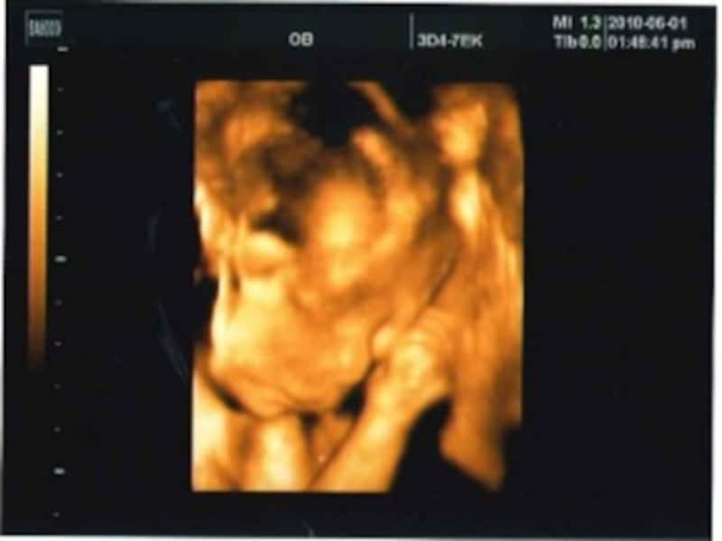 妊娠25週（妊娠7ヶ月,七ヶ月,7カ月）エコー写真・超音波写真