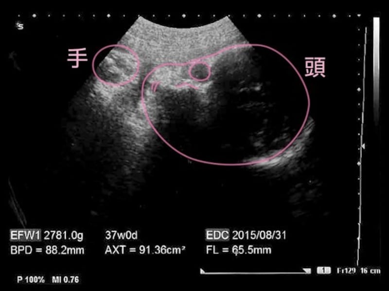 妊娠10ヶ月,十ヶ月,妊娠10カ月(妊娠37週)