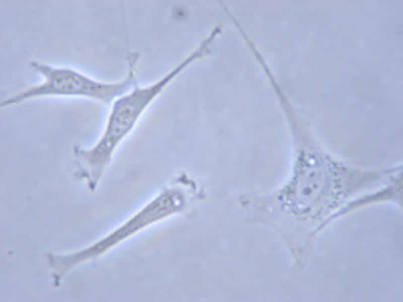 //imgcp.aacdn.jp/img-a/800/auto/aa/gm/article/2/9/8/6/2/5/fibroblast_1.jpg
