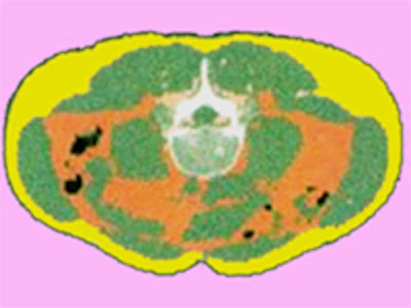 輪切りの腹部の映像