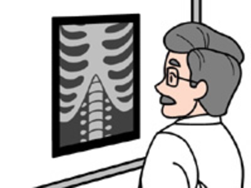 肺に影があるとき考えられる病気 再検査の必要性 健康診断 検診 人間ドック All About