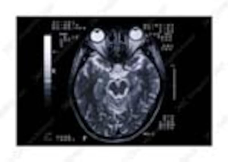 MRIは磁気で調べます!