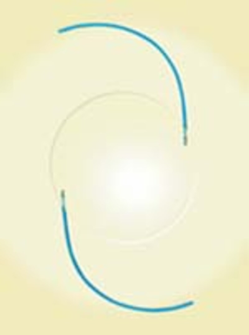 眼内レンズ:株式会社ニデック提供