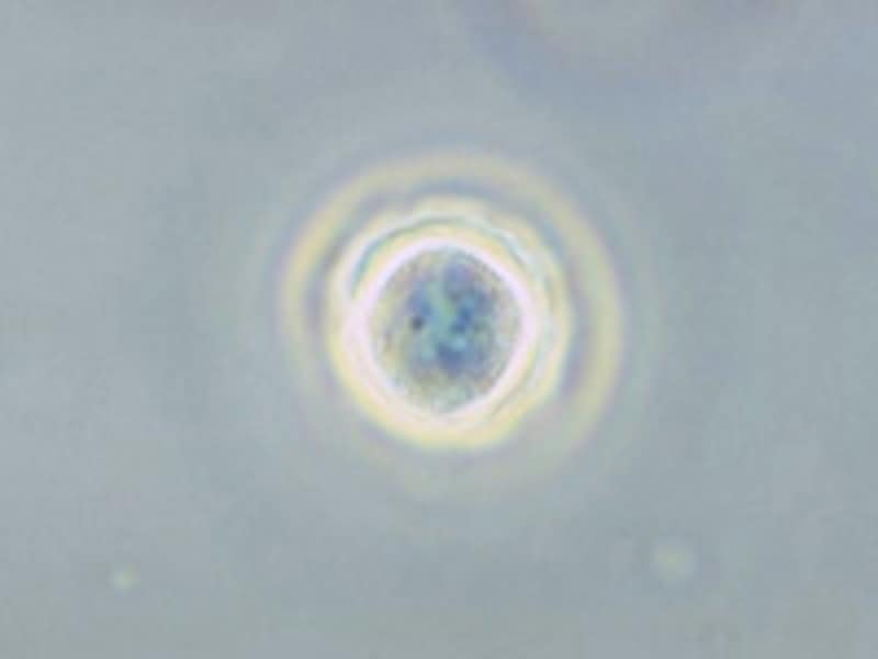 //imgcp.aacdn.jp/img-a/800/auto/aa/gm/article/2/9/9/5/3/0/acanthamoeba_01.jpg
