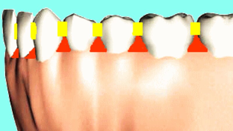 デンタルフロスと歯間ブラシの使い方