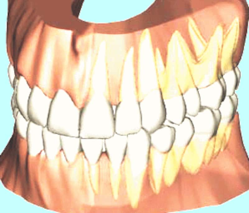 歯肉の内部
