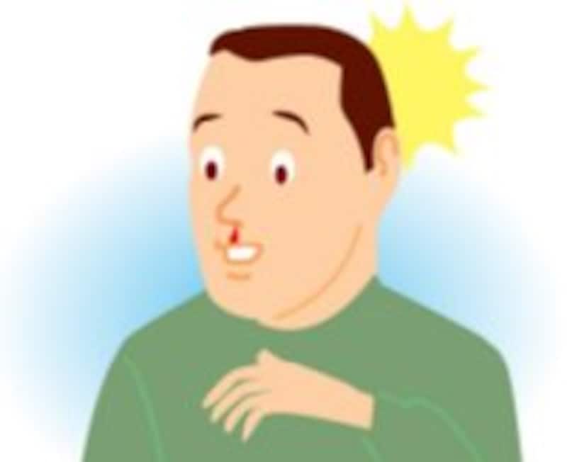 鼻血の原因で最も多いのは？