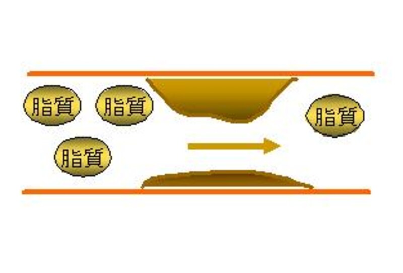 血管は水道のホースと同じ
