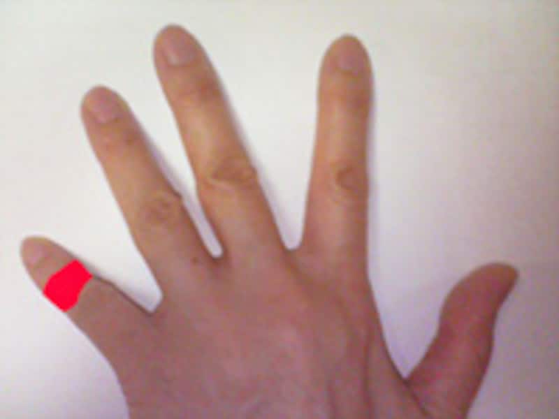 finger_injury"