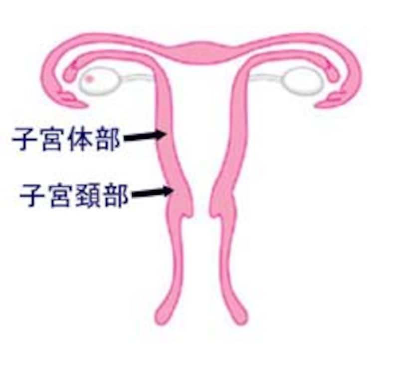 子宮の入り口にできる癌が子宮頚癌