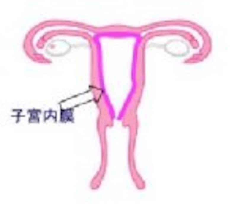 子宮内膜症も増加中