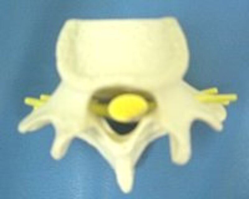 背骨を上から見た図（黄色いものが脊髄神経）